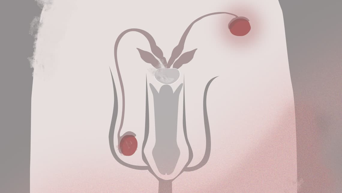 Testis yang Tidak Turun (Kriptorkismus)